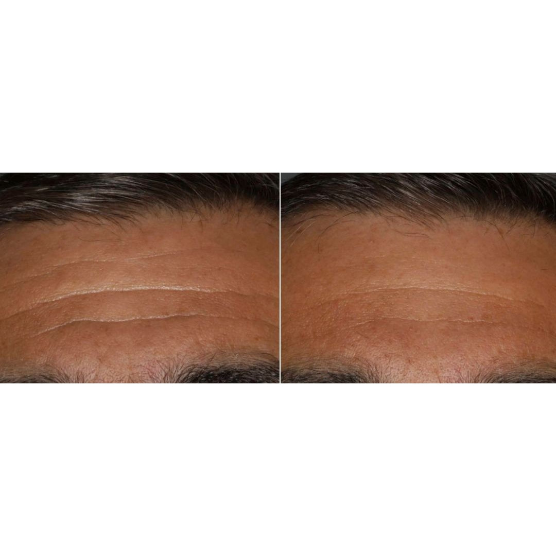 VENSYL FACEBOOSTER - Men's Best Face Cream Moisturizing Face Wash Serum Men's Face Mask