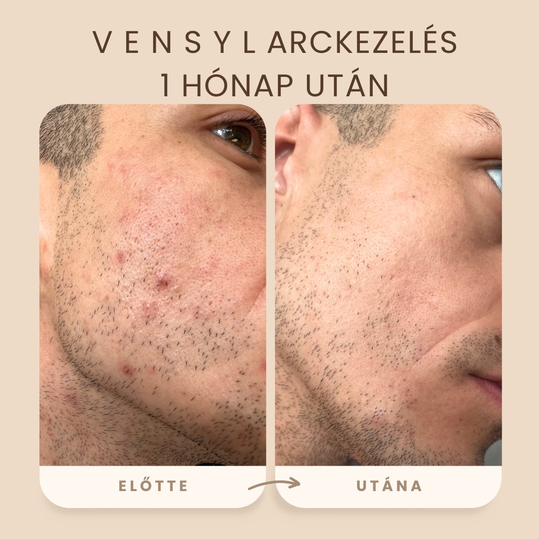 Vensyl Anti-aging Ár-érték LEGJOBB Férfi Arcápolási Csomag - Arckrémek