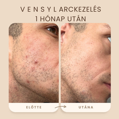 Vensyl Anti-aging Ár-érték LEGJOBB Férfi Arcápolási Csomag - Arckrémek