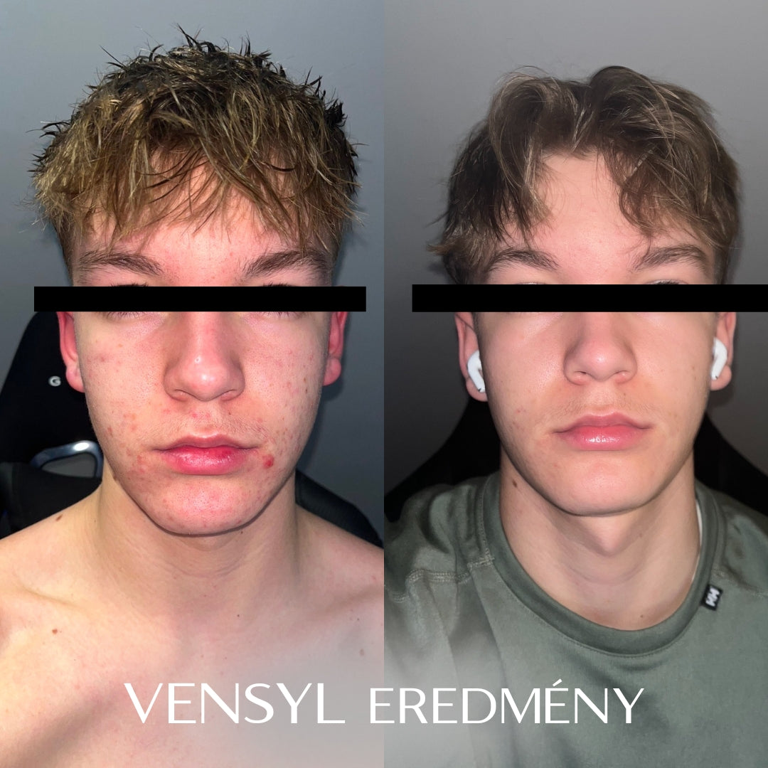 Vensyl Aurum Best Men's Face Cream Moisturizer
